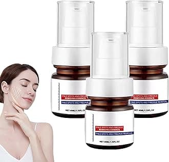 Dark 𝐒𝐩𝐨𝐭 Remover for Face, 𝐖𝐡𝐢𝐭𝐞𝐧𝐢𝐧𝐠 and 𝐅𝐫𝐞𝐜𝐤𝐥𝐞 Removing Essence, Dark 𝐒𝐩𝐨𝐭 Corrector for Face and Body, Korean 𝐖𝐡𝐢𝐭𝐞𝐧𝐢𝐧𝐠 Skin Care Cream (3PC, 40ml)