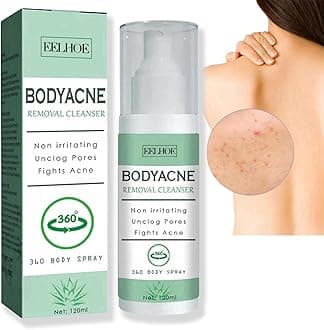 Back Acne Treatment Spray - Body Acne Moisturizer for Smooth Skin - Skin Care Spray for Back and Body